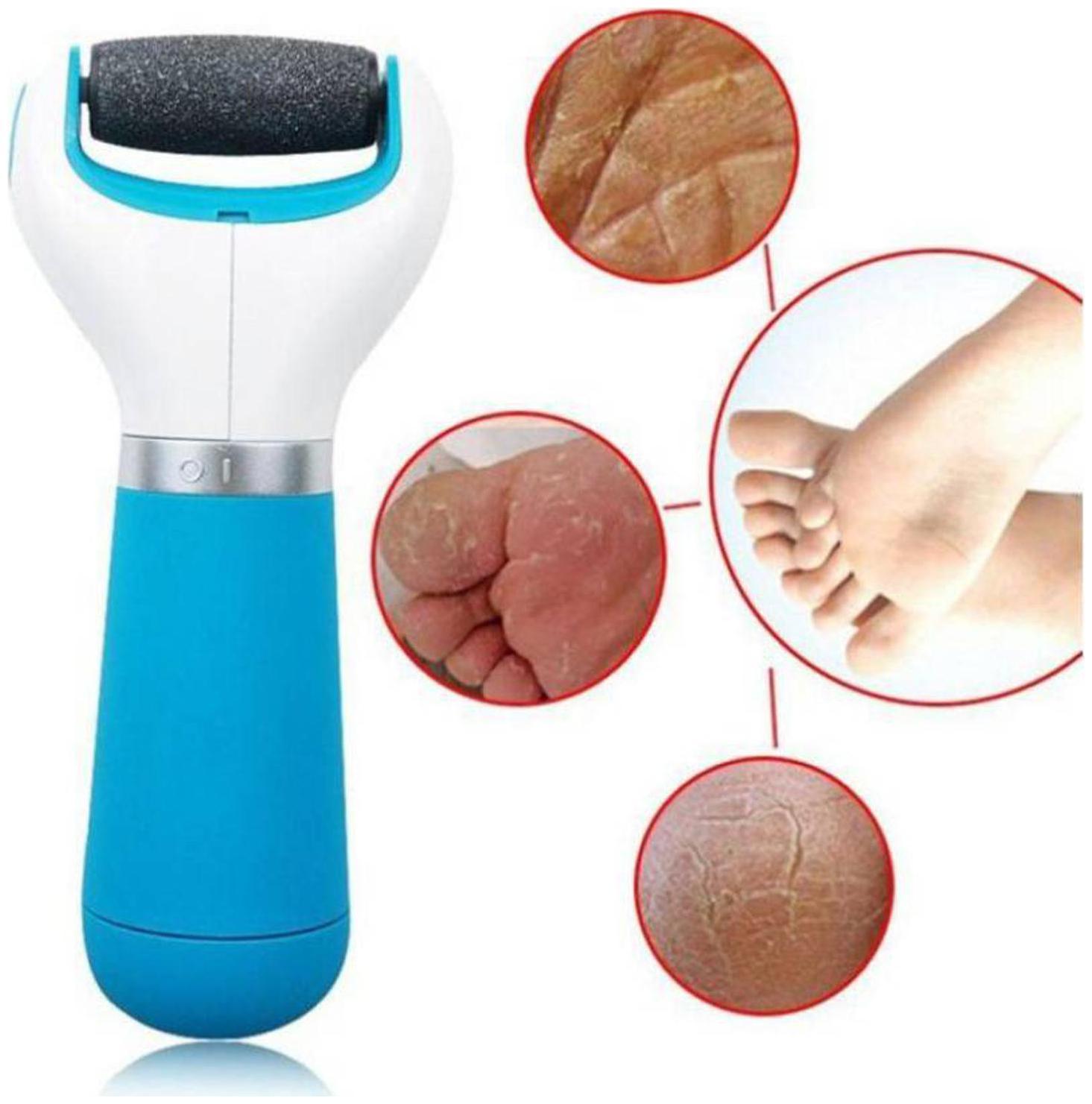Roller Scholl Velvet Smooth Electronic Nail Care System Pedicure Manicure Foot File Buff Smoother Shine Tool with Diamond Crystal Dead skin Callus Remover
Roller Scholl Velvet Smooth Electronic Nail Care System Pedicure Manicure Foot File Buff Smoother Shine Tool with Diamond Crystal Dead skin Callus Remover