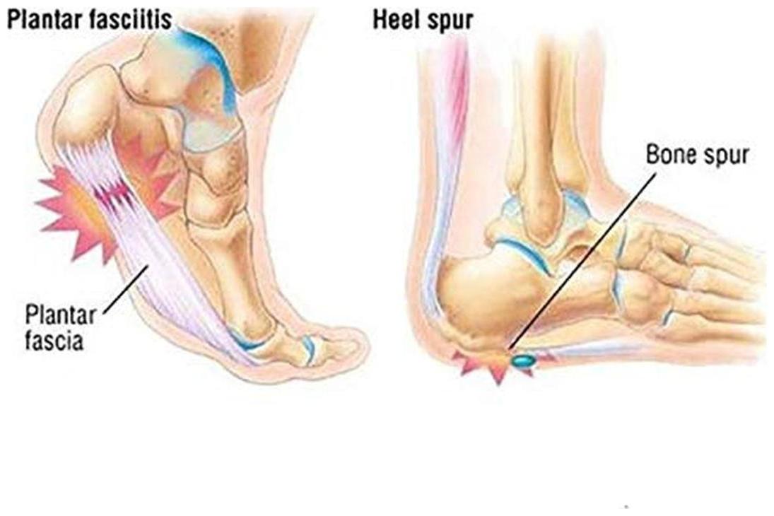 

ANTI-CRACK SILICON HEEL PROTECTOR SET PAIR CRACKED FOOT SKIN CARE