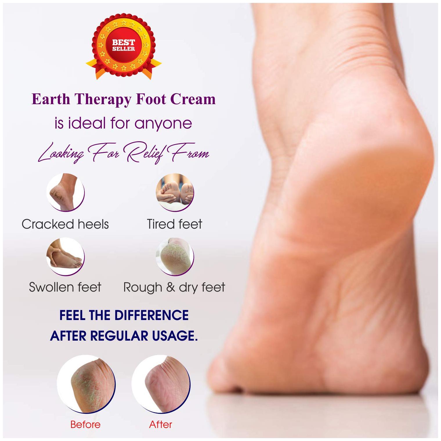 the best treatment for cracked heels