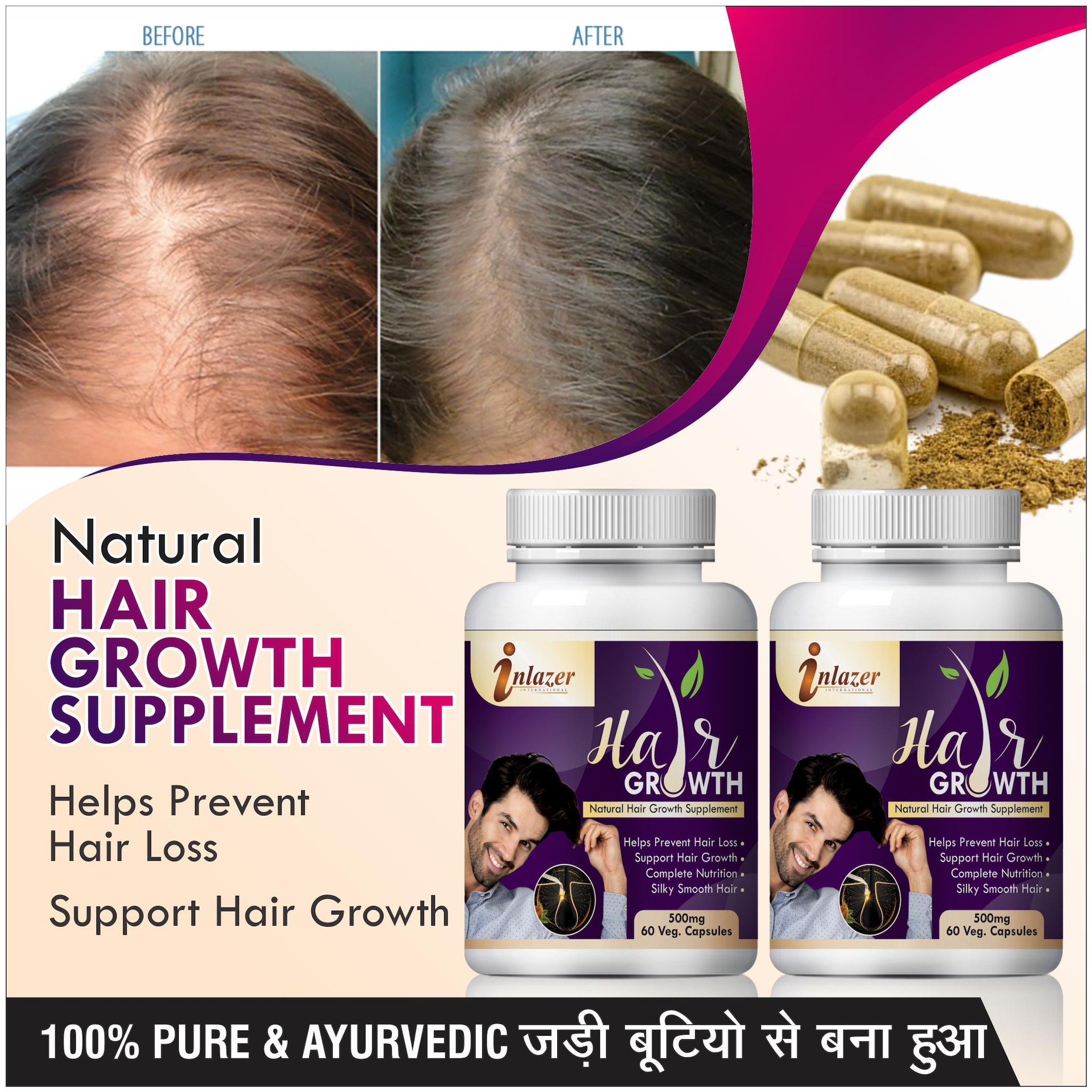 

Inlazer Hair Growth Herbal Capsules For Remove Hair Spilit Ends 500mg 100 Ayurvedic