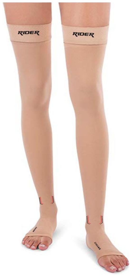 

Just Rider Cotton Compression Stockings Thigh Length for Varicose Veins Medium