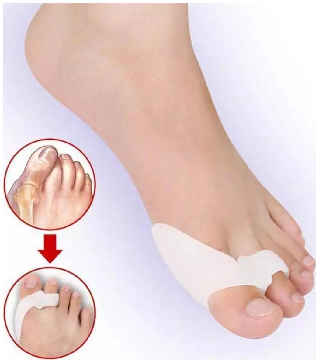 

MAB - Silicone Soft Gel Double Toe Seperator for Bunion Pain Crooked Toes -Pack of 2 Pair