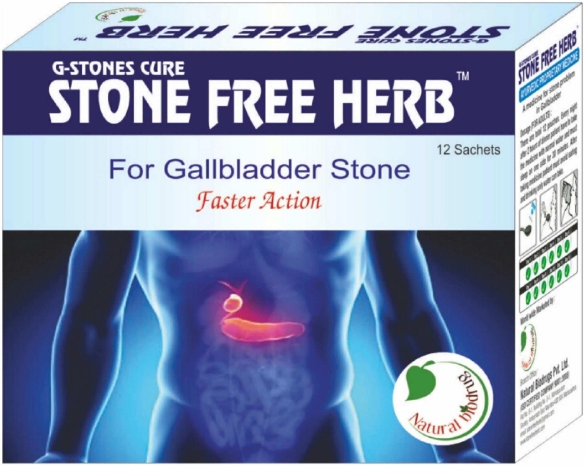 

STONE FREE HERB G STONE CURE For Gallbladder stone 12 g